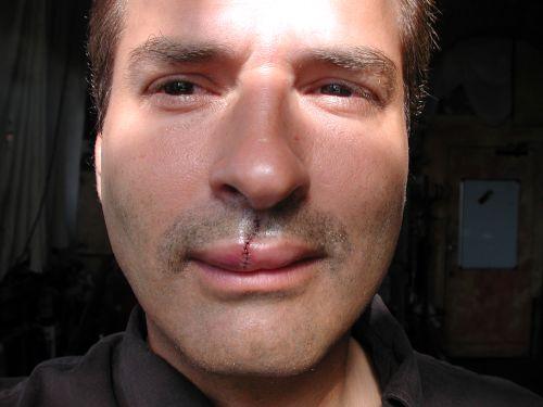 lip.jpg